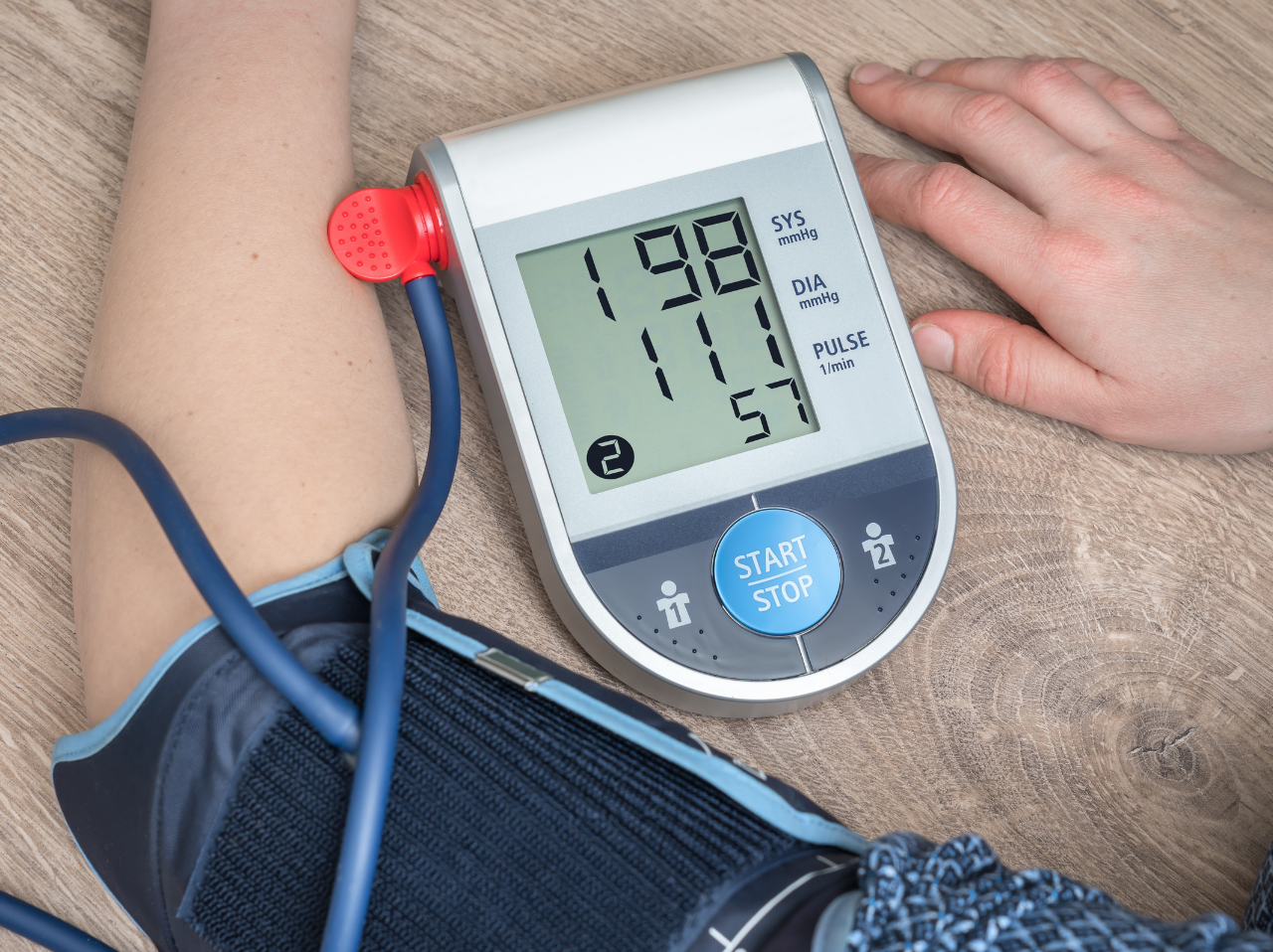 Does High Blood Pressure Cause Hair Loss?