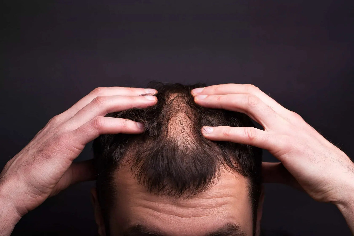 Stop AGA Hair Loss – Proven Ways to Support Hair Regrowth