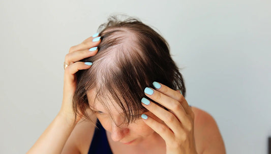 Understanding Autoimmune Hair Loss in Women and Its Causes