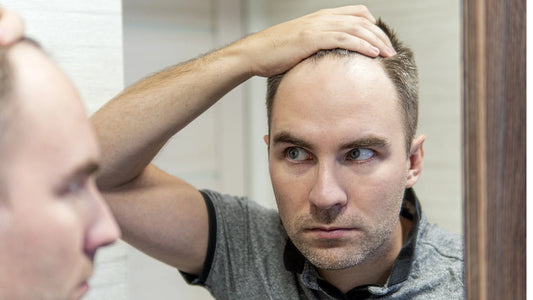 Bad Receding Hairline: Causes, Types, and How to Fix Hairline