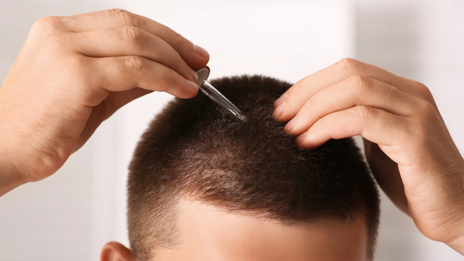 What Happens If I Stop Using Minoxidil?