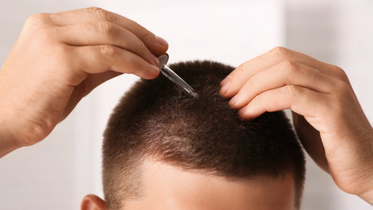 What Happens If I Stop Using Minoxidil?