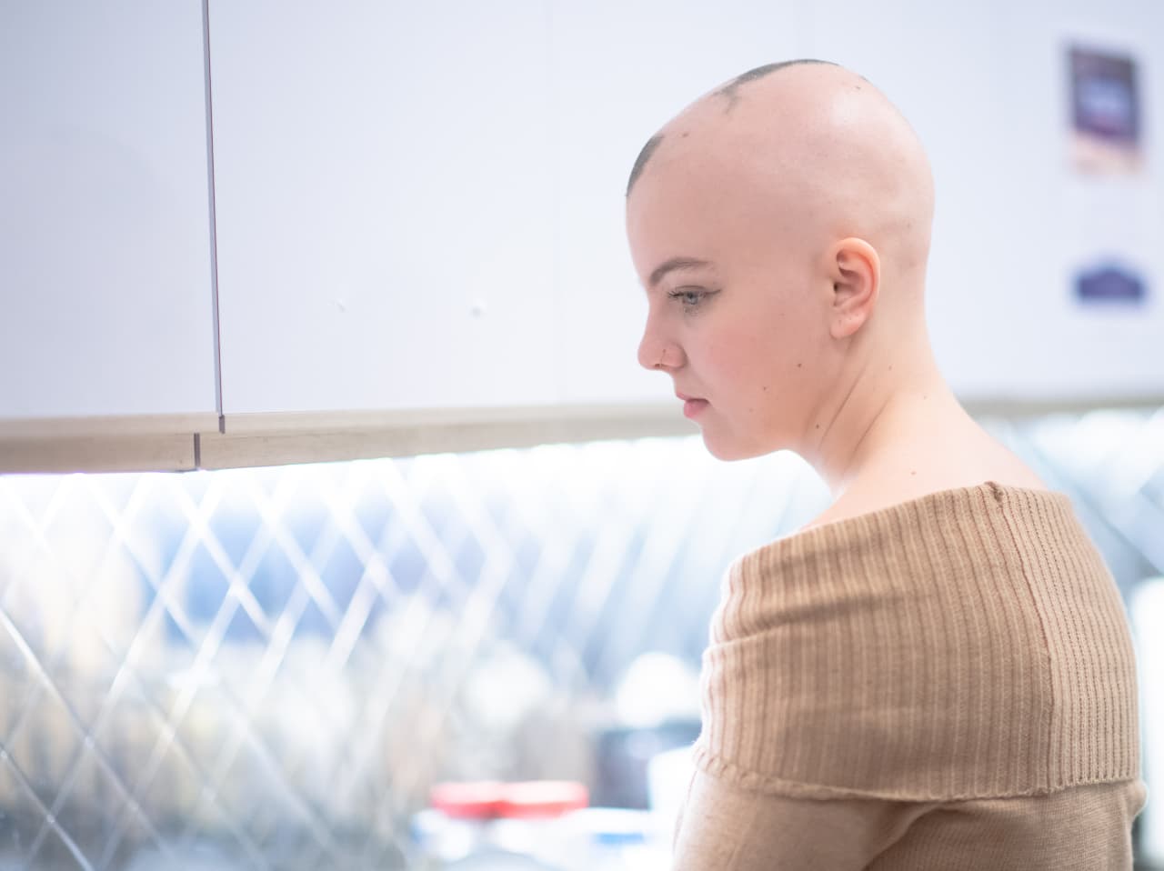 What Causes Alopecia in Childhood? A Parent’s Guide