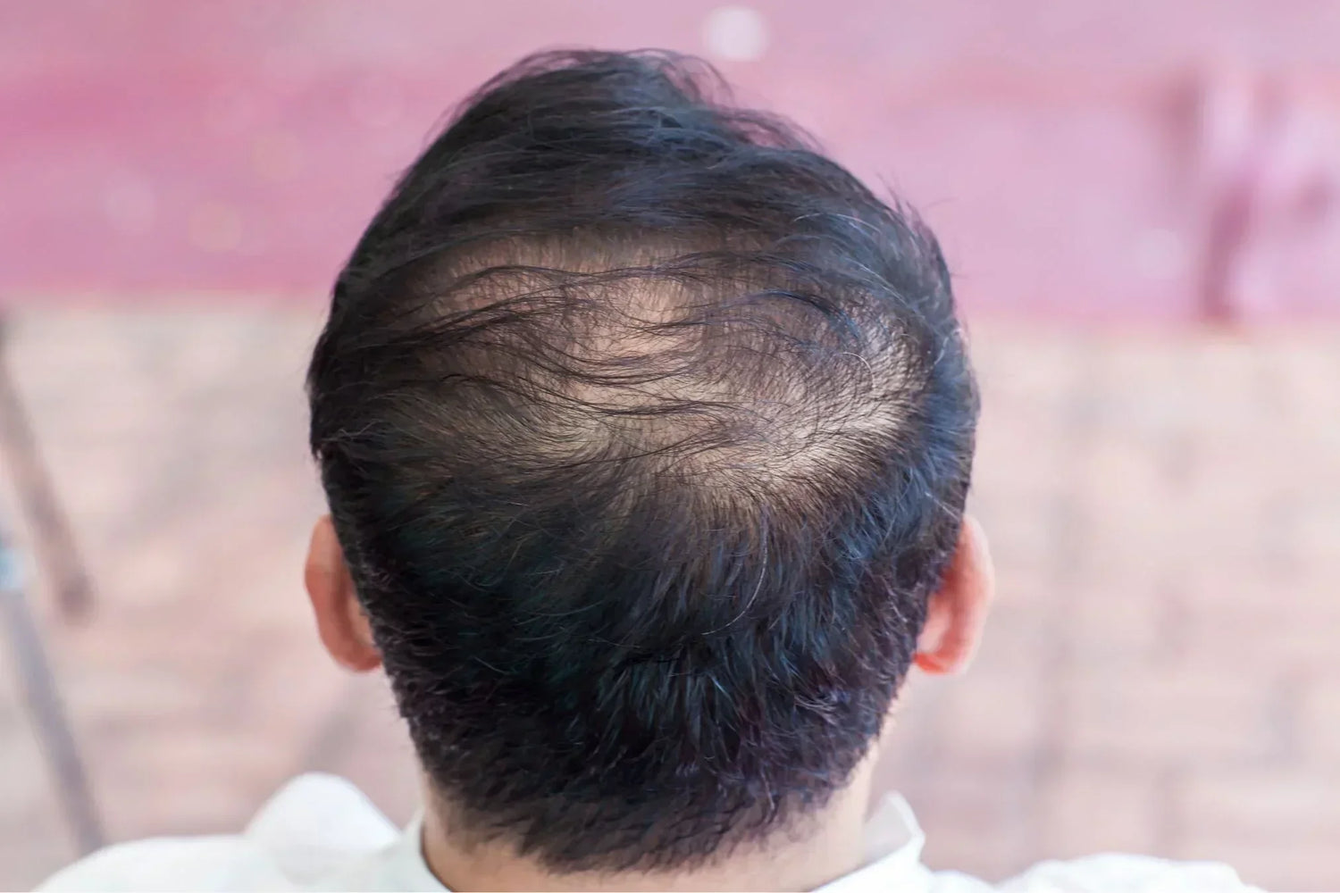 Can It Work? Does Blocking DHT Regrow Hair? Explained
