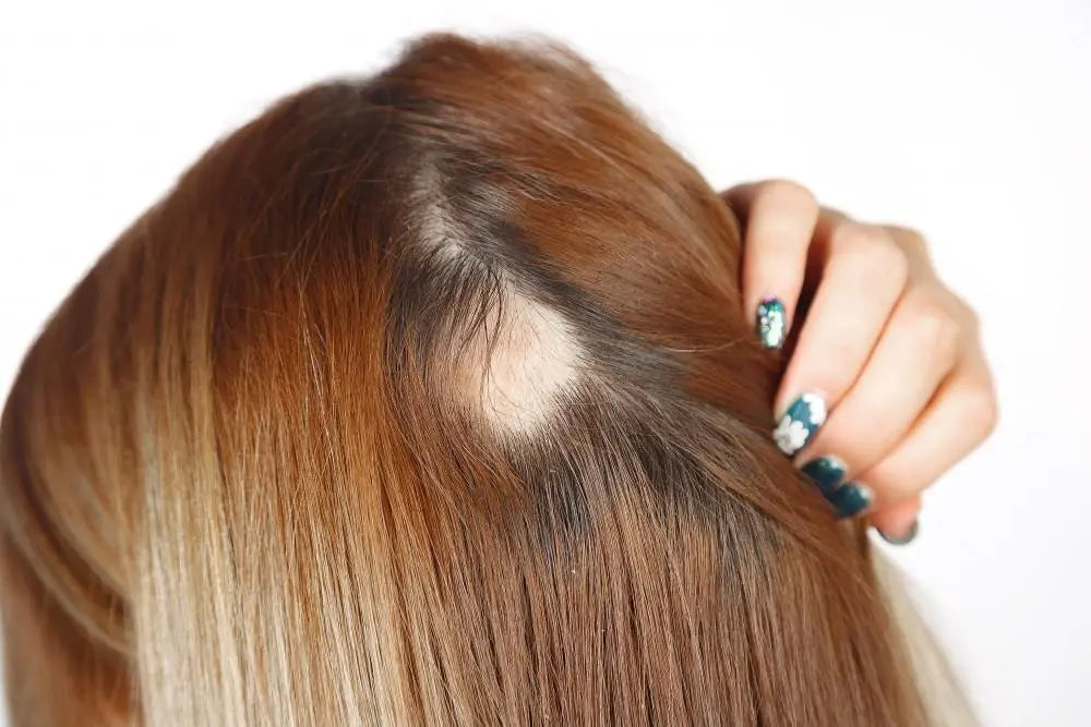 How to Hide Bald Spot Woman Using Styling and RootMD Care