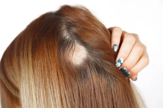 How to Hide Bald Spot Woman Using Styling and RootMD Care