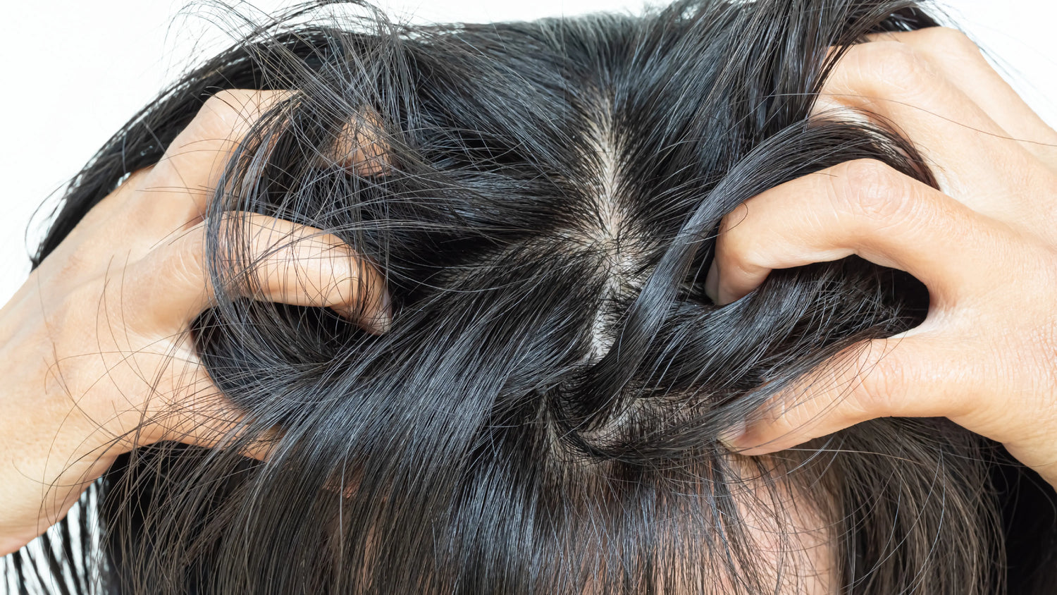 Itchy Scalp Hair Loss: Causes, Treatments, and When to Worry