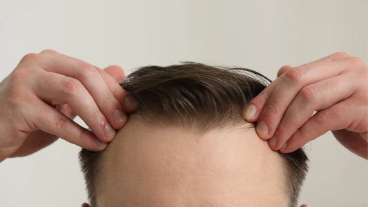 Premature Balding: Causes, Early Hair Loss, and What Helps