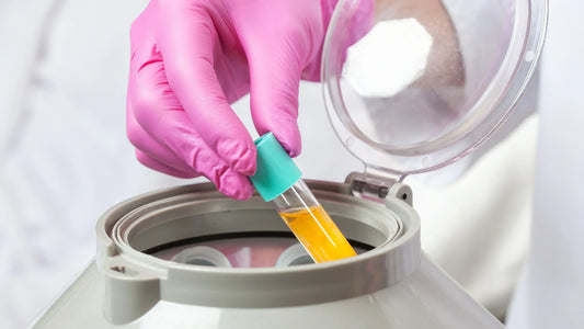 PRP for Hair Loss: Results, Cost, and Effectiveness (Guide)