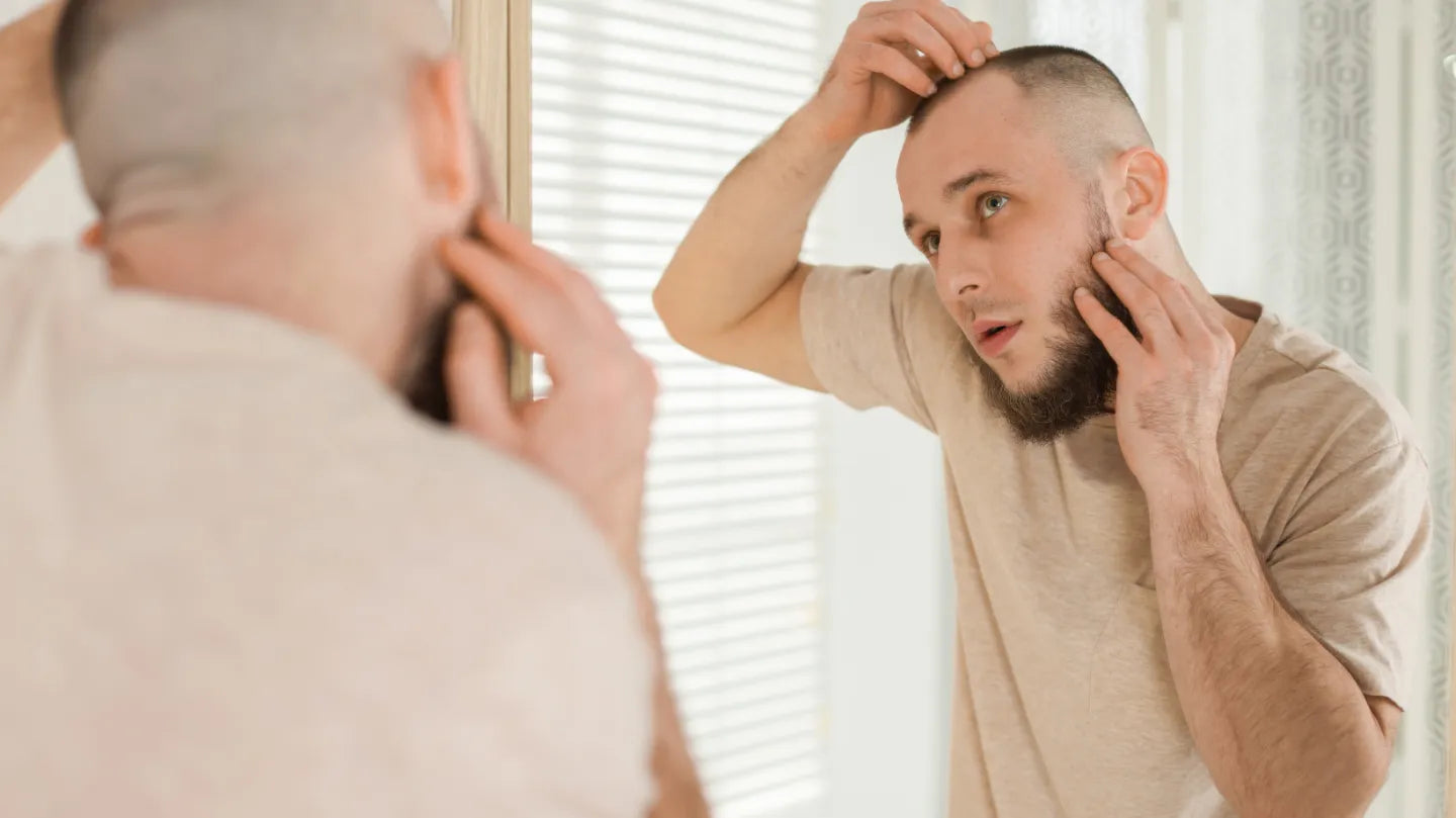 Receding Hairline in Men: Causes, Treatments