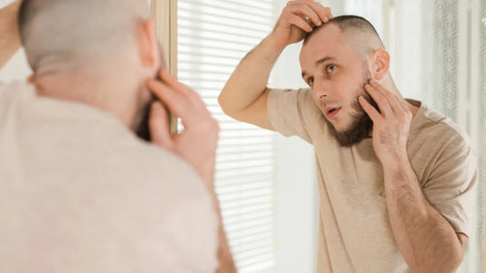 Receding Hairline in Men: Causes, Treatments