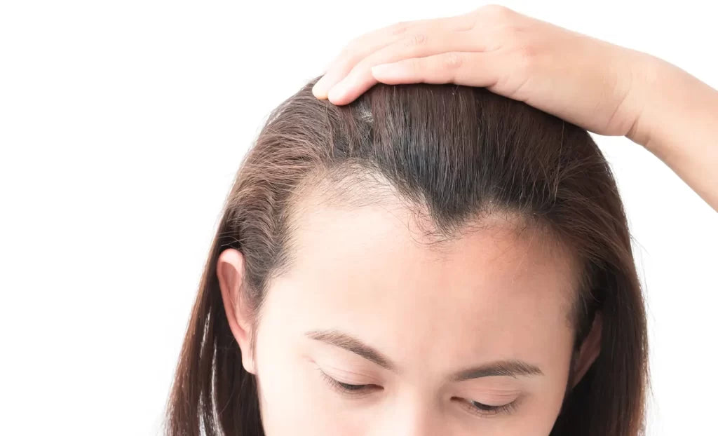 Regrow Hairline Naturally vs Medical Options: What Works Best?