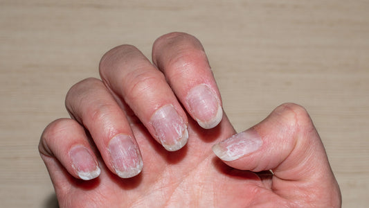 How Thyroid Issues Affect Nails? Nail Changes Explained