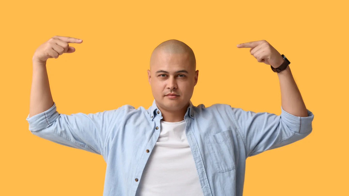 When Do Men Start Balding? Age, Causes, and Signs Guide