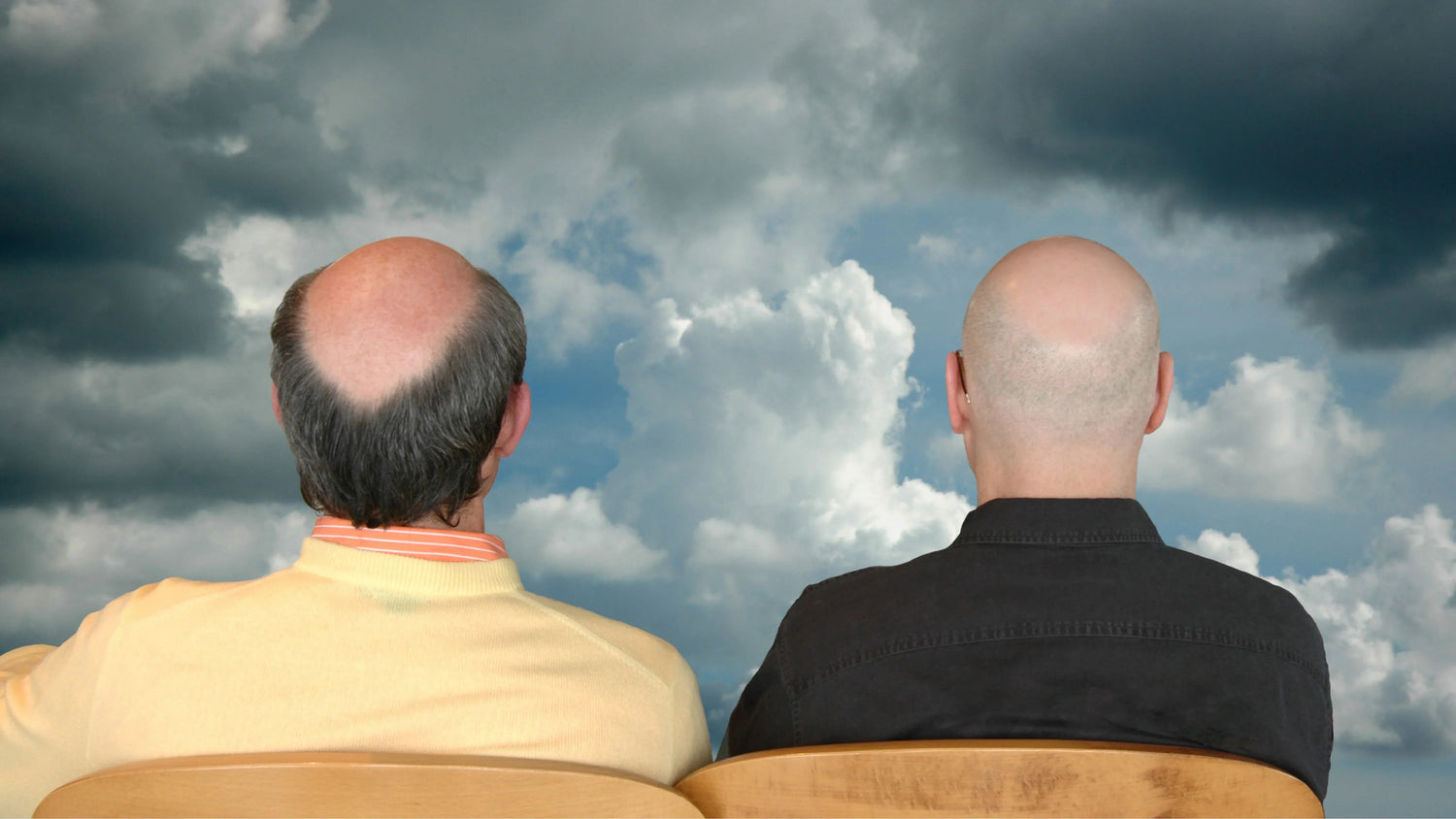 Male Pattern Baldness and Genetics: Why Is My Hair Falling Out?