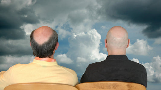 Male Pattern Baldness and Genetics: Why Is My Hair Falling Out?