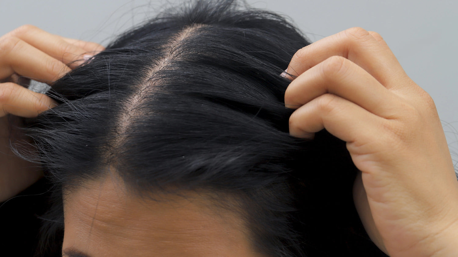 Widening Hair Part: Normal vs Thinning Explained