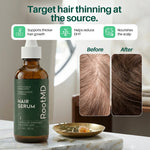 Hair Growth Serum