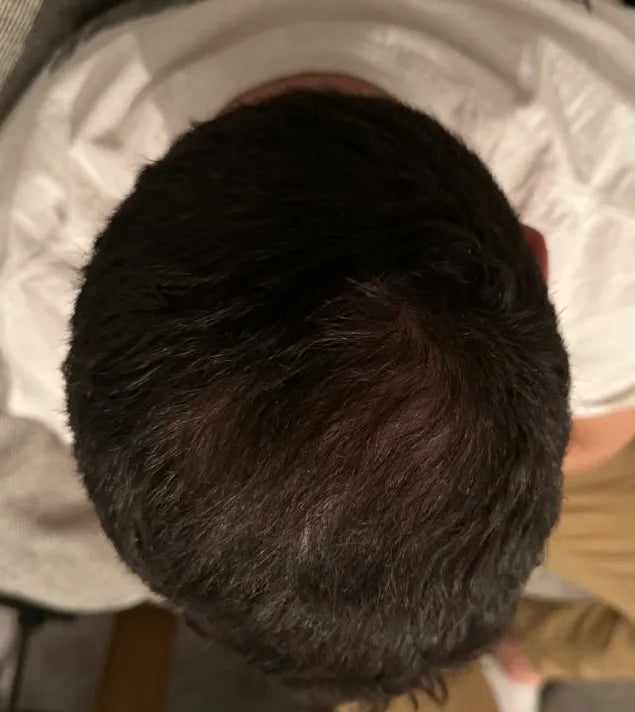 Crown after