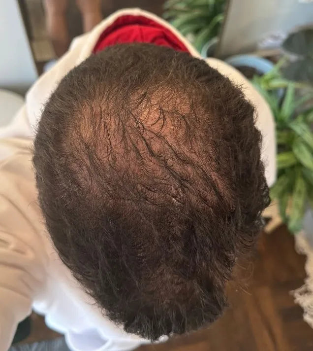 Crown before