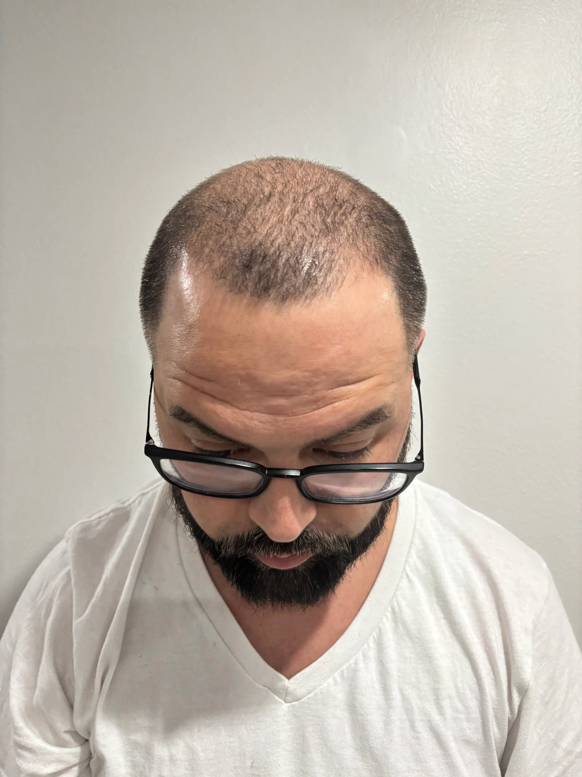 Before customer result