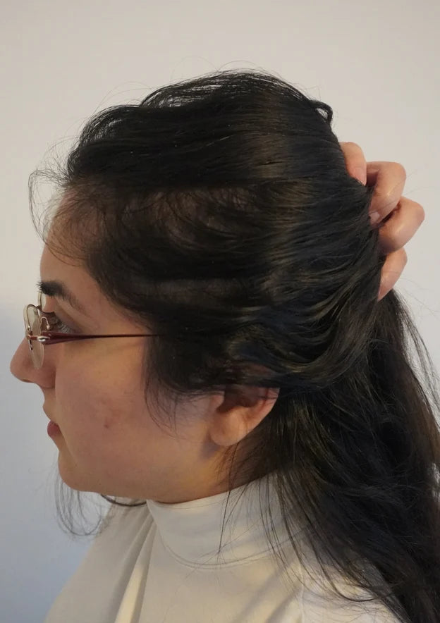 Same woman with fuller-looking hair along the part, side view, after