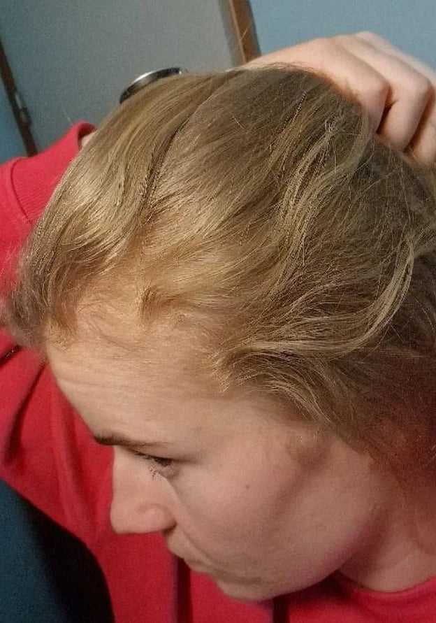 Same woman with denser-looking hair along the part, top view, after