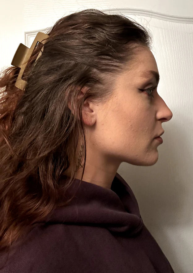 Same woman with fuller-looking hair at the temple, side profile, after