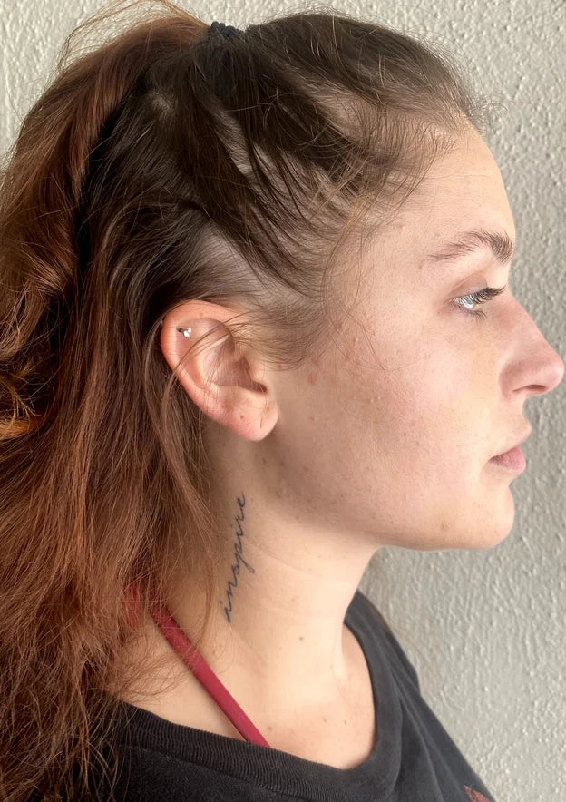 Woman with thinning hair at the temple and hairline, side profile, before